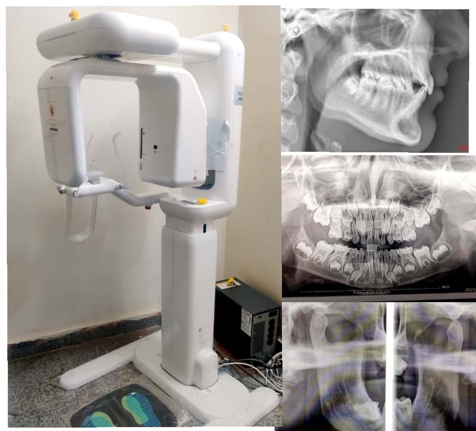 ydc dental x ray service